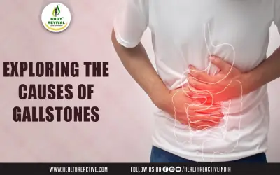 Exploring the Causes of Gallstones