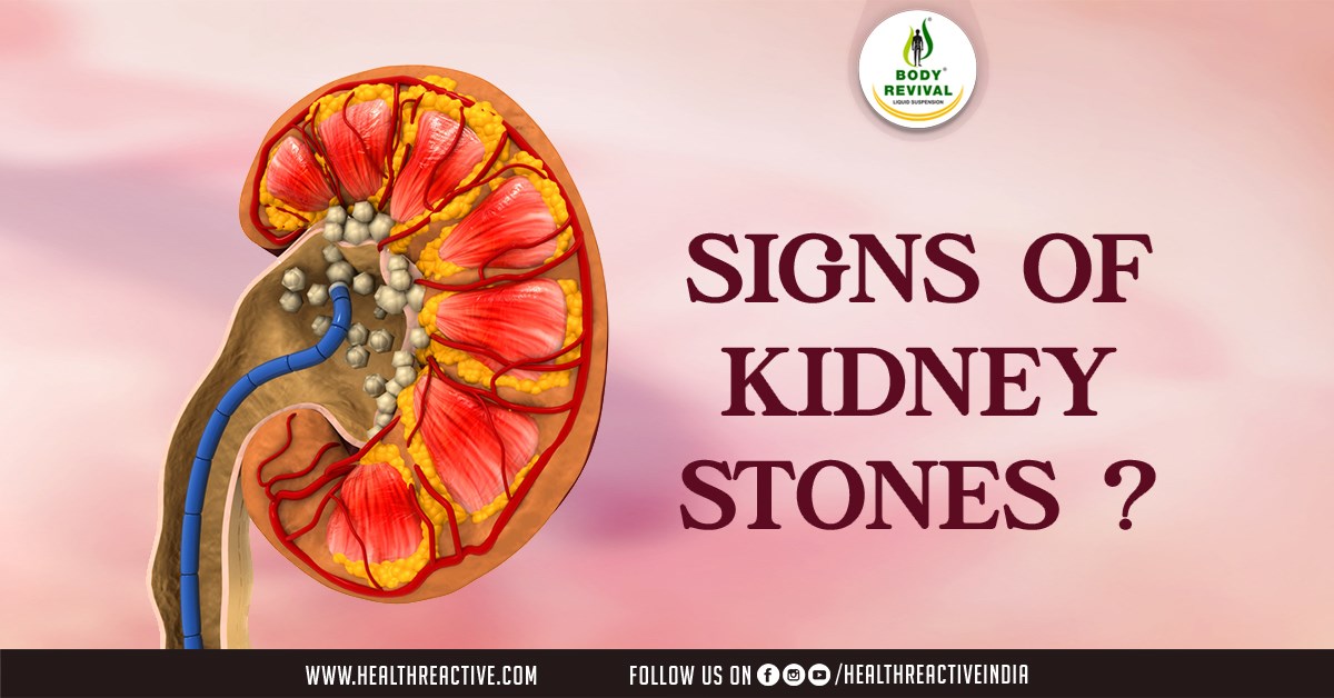 Understanding the Signs Early Detection of Kidney Stones Health