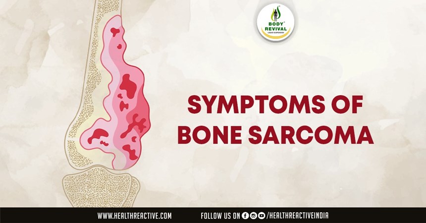Unraveling the Enigma: Recognizing the Symptoms of Bone Sarcoma